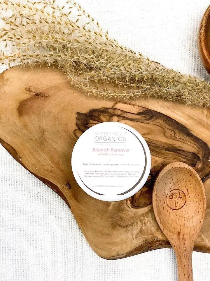 Organic Blemish Cream/ Dark Spot Remover / Scar Cream / Acne Spot - Thrivera